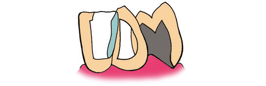 Logo Dellacherie Michel