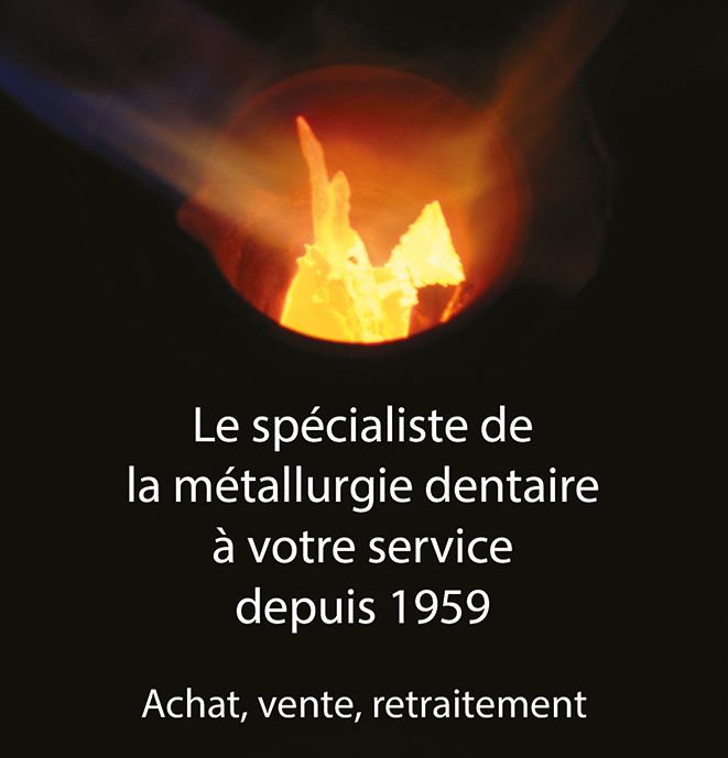 Alliages métaux précieux
