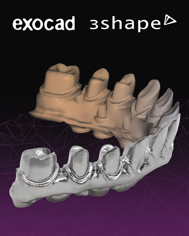 Barres usinées pour implants