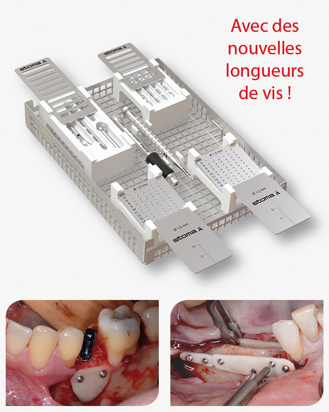 Instruments pour la chirurgie implantaire