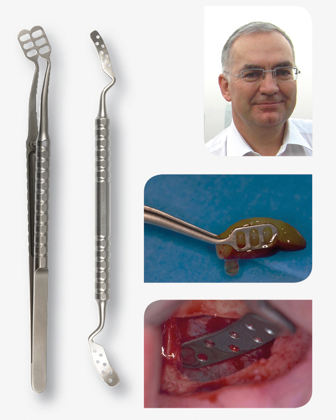 Instruments pour la chirurgie implantaire