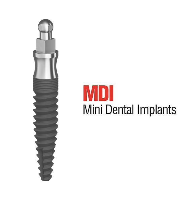 Mini-implants