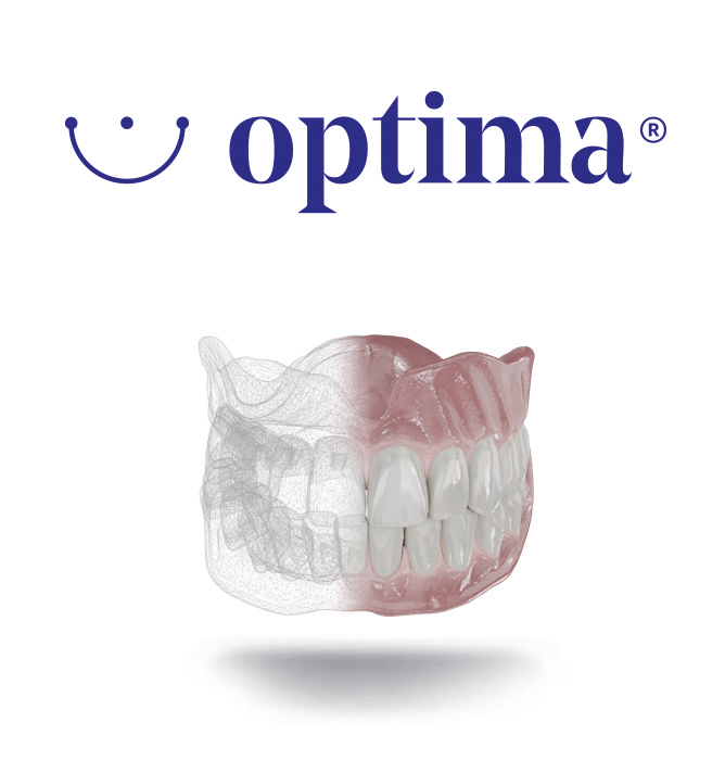 Prothèse hydride amovible