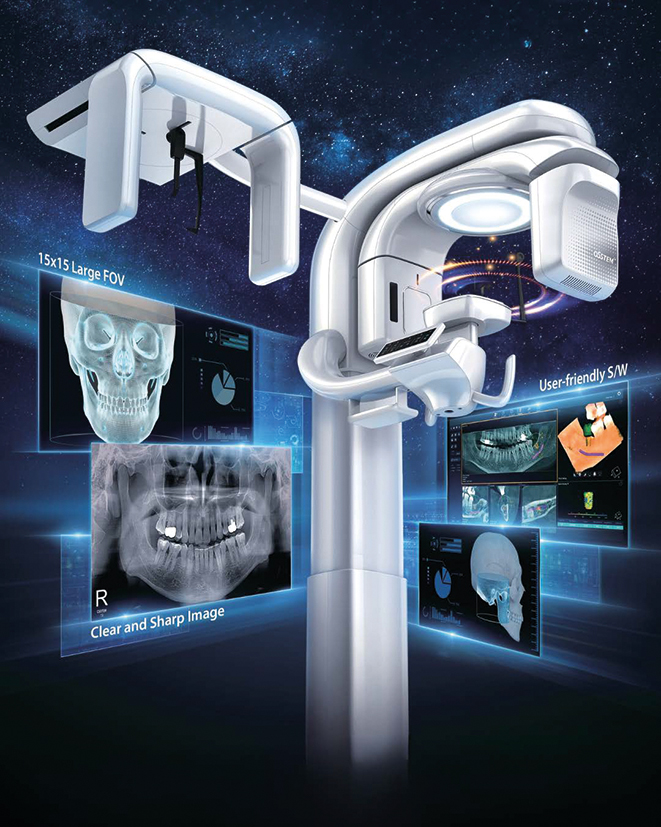 Scanner 3d