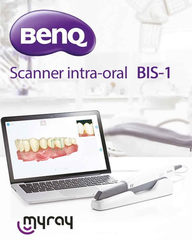 Scanner intra-oral