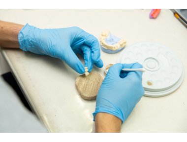 Laboratoires dentaires : votre déclaration ANSM et votre traçabilité sont-elles conformes ?
