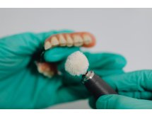 Entre choix de laboratoire et sécurité patient : quel vrai prix pour vos prothèses ?