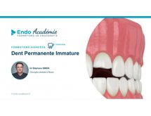 Dent Permanente Immature – Session 2022
