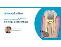 Chirurgie Endodontique session 2022
