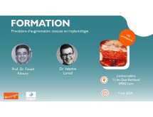 Procédure d'augmentation osseuse en implantologie