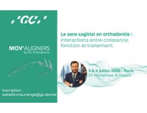 MOV'ALIGNERS - Le sens sagittal en orthodontie