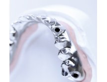 Armatures et couronnes Titane