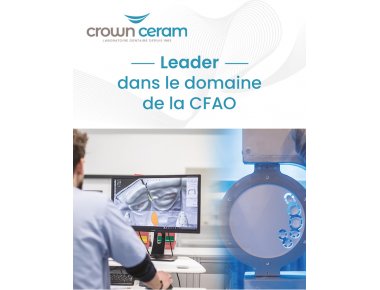 CFAO