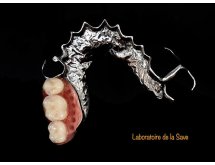 Châssis métallique