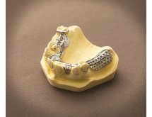 Châssis métallique