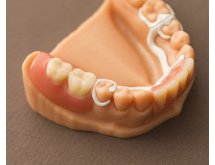 Châssis métallique