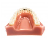 Fils orthodontiques (cab)