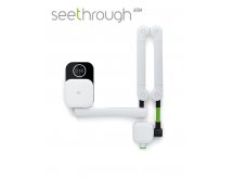 Imagerie numérique intra-orale