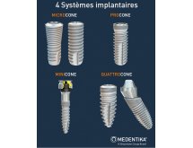 Implants