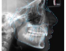Logiciels d'aide au diagnostic
