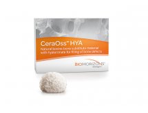 Matériaux de comblement/de reconstruction osseuse-régénération tissulaire