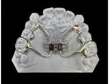 Orthodontie