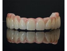 Prothèse complète adjointe