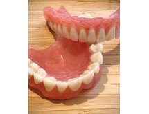 Prothèse complète adjointe