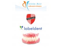 Prothèse conjointe composite