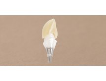 Prothèse sur implant