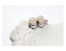 Attachements et rupteurs