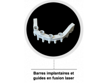 Barre sur implants