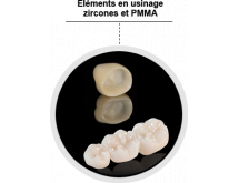 Armatures et couronnes zircone/disilicate de lithium/alumine