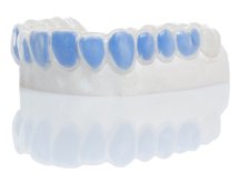 Gouttière pour blanchiment