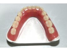 Prothèse complète adjointe