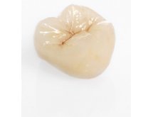 Prothèse conjointe composite