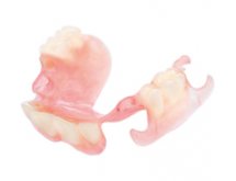 Prothèse partielle acrylique adjointe