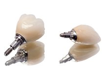 Prothèse sur implant