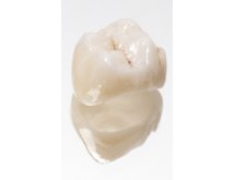 Prothèse zircone