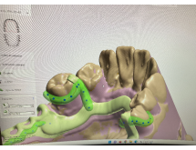 Châssis métallique