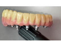 Prothèse conjointe composite