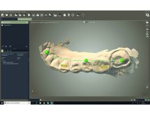 Traitement des empreintes numériques