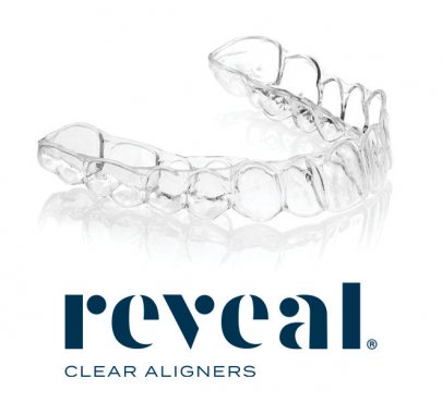Aligneurs