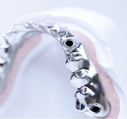 Armatures et couronnes Titane