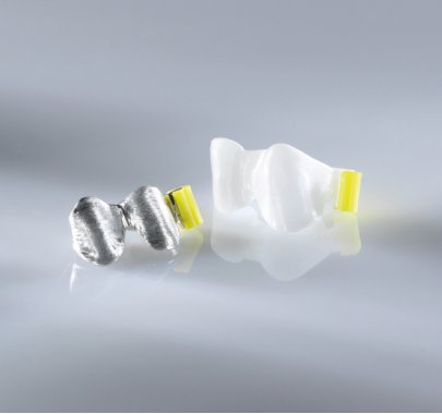 Armatures et couronnes zircone/disilicate de lithium/alumine