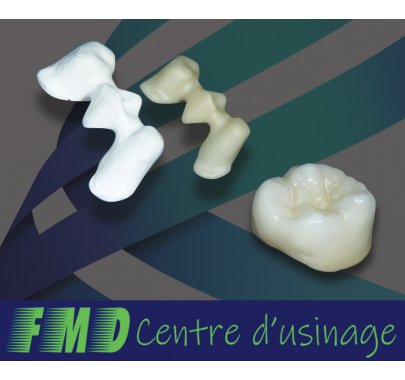 Armatures et couronnes zircone/disilicate de lithium/alumine
