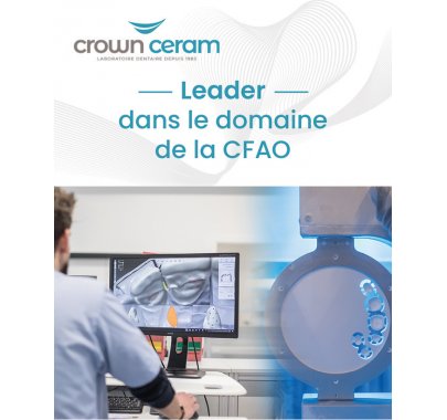 CFAO