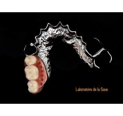 Châssis métallique