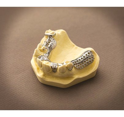 Châssis métallique