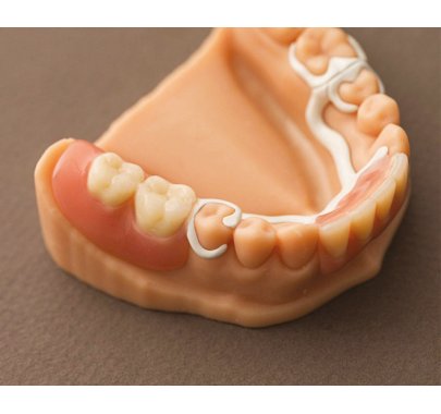 Châssis métallique